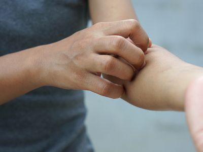 Σοβαρές παθήσεις που εκδηλώνονται με δερματικά συμπτώματα (εικόνες)