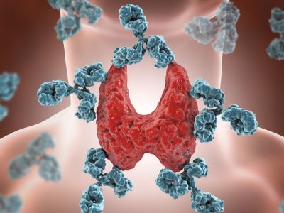 Υποθυρεοειδισμός: 8 συμπτώματα σε εικόνες