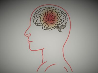 Κορονοϊός: Γιατί το εμβόλιο της AstraZeneca προκαλεί θρομβώσεις