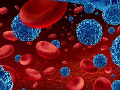 Λέμφωμα: Τα ύποπτα συμπτώματα που πρέπει να γνωρίζετε (εικόνες)