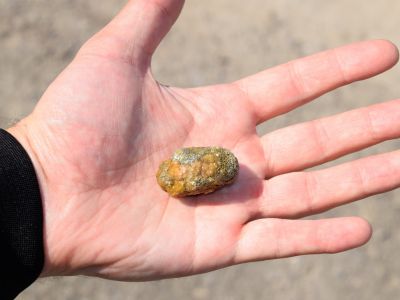 Πέτρες στη χολή: 5 σημάδια που στέλνει το σώμα (εικόνες)