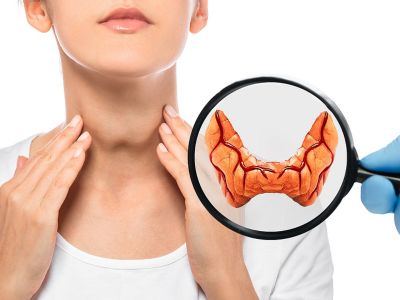 Άγνωστα σημάδια ότι ο θυρεοειδής δεν λειτουργεί φυσιολογικά (εικόνες)