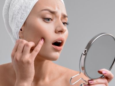 Επτά λόγοι που εμφανίζονται σπυράκια στο πρόσωπο (εικόνες)