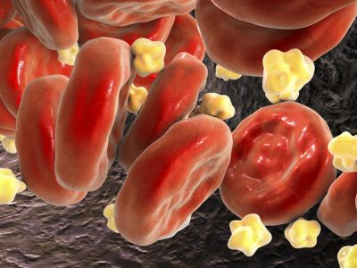 Πέντε πανεύκολα βήματα για τη μείωση της χοληστερίνης (εικόνες)