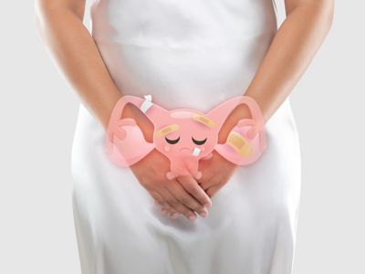 Κύστες στις ωοθήκες: Με ποια συμπτώματα εκδηλώνονται (εικόνες)