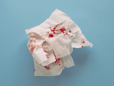 Αίμα από τη μύτη: Για ποιες παθήσεις προειδοποιεί (εικόνες)