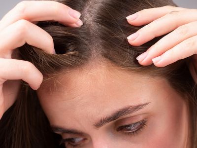 Οι επιπτώσεις του στρες στα μαλλιά σας (εικόνες)