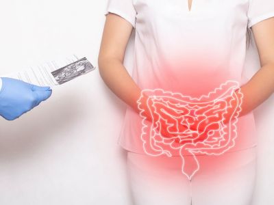 Φλεγμονή εντέρου: Με ποια συμπτώματα εκδηλώνεται (εικόνες)