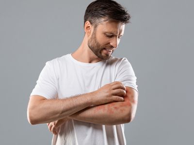 Έκζεμα ενηλίκων: Για ποιες καρδιαγγειακές παθήσεις αυξάνει τον κίνδυνο (εικόνες)