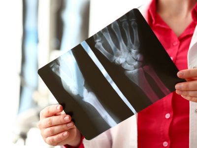 Καρκίνος στα οστά: Κοινά και σπάνια συμπτώματα (εικόνες)