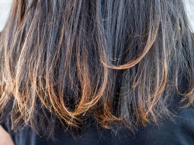 Οι τροφές που επαναφέρουν τα ξηρά και σπασμένα μαλλιά (εικόνες)