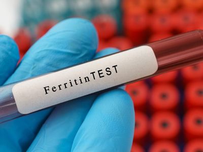 Χαμηλή φερριτίνη: Ποιες είναι οι πιθανές αιτίες (εικόνες)