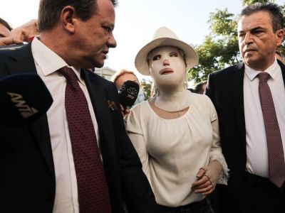 Ιωάννα Παλιοσπύρου: Τι της ζήτησε ο δικηγόρος της γυναίκας που της πέταξε το βιτριόλι