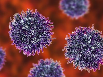 6 τροφές που μειώνουν τον κίνδυνο καρκίνου (εικόνες)