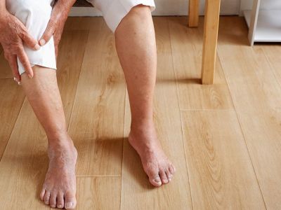 Πρόβλημα κυκλοφορίας στα πόδια: Οι πιθανές αιτίες (εικόνες)