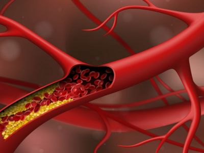 Υψηλή χοληστερόλη: Η κατανάλωση ωμέγα 3 συμβάλει στην προστασία της καρδιάς