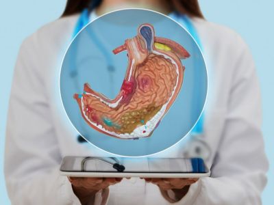 Σύνδρομο μηρυκασμού: Τα συμπτώματα, τα αίτια, οι επιβαρυντικοί παράγοντες και οι επιπλοκές