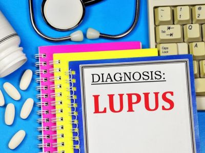 Παγκόσμια Ημέρα Λύκου: Τα συμπτώματα της νόσου που «χτυπά» τις γυναίκες (εικόνες)