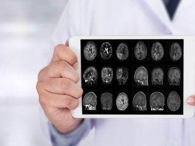 Σε τι διαφέρει ένας όγκος από μια εγκεφαλική βλάβη και πότε μιλάμε για καρκίνο;