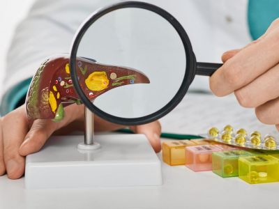 Λιπώδης διήθηση: Τι περιλαμβάνει η διατροφή για την αντιμετώπισή της