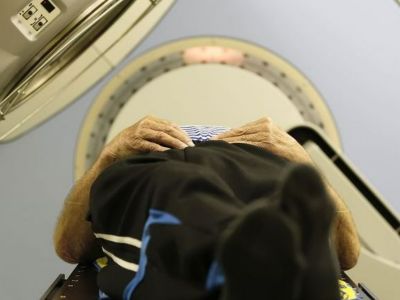 Η ενιαία μαγνητική τομογραφία διαγιγνώσκει τη μελέτη Αλτσχάιμερ πρώιμου και προχωρημένου σταδίου