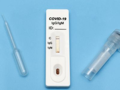 Οι επιστήμονες αναπτύσσουν τεστ COVID-19 που μπορεί να εντοπίσει μεταλλάξεις σε ώρες - μελέτη