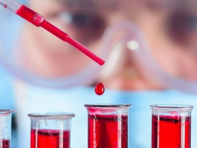 Νομίζετε ότι έχετε σχιζοφρένεια; Μια απλή εξέταση αίματος δίνει την οριστική απάντηση