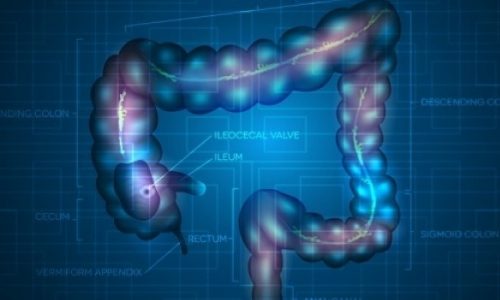 Πότε οι ενοχλήσεις στην κοιλιά δείχνουν σκωληκοειδίτιδα