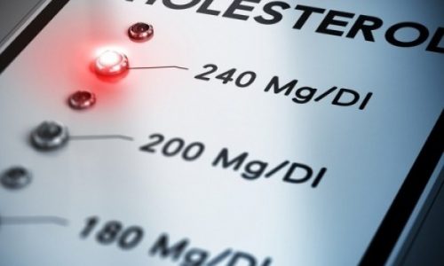 Έχετε χοληστερίνη; Δείτε το από τα μάτια σας!