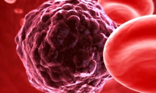 Πώς θα μειώσετε κατά 43% τις πιθανότητες να προσβληθείτε από καρκίνο