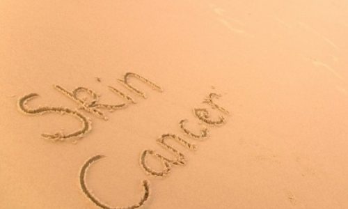 Προστατευθείτε: Μοιάζει με απλό σπυράκι αλλά είναι οζώδες μελάνωμα (Εικόνες)