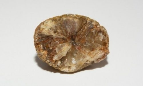 Πέτρες στη χολή - Πώς να τις καταπολεμήσετε με φυσικό τρόπο