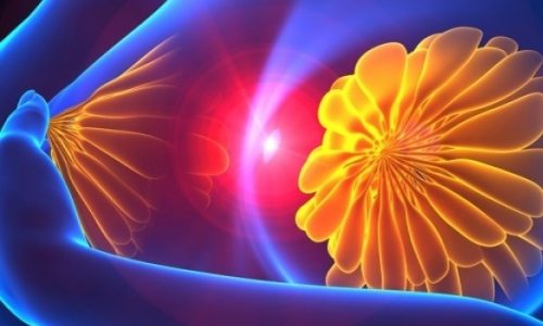 Αυτοεξέταση μαστού: Πώς θα ερμηνεύσετε τα ευρήματα