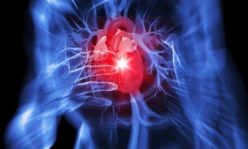 Αθόρυβο έμφραγμα: Πώς θα το αναγνωρίσετε