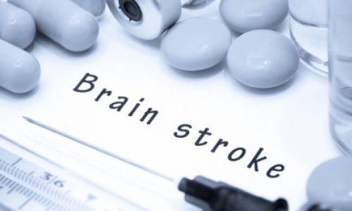 Το φρούτο που προστατεύει από το εγκεφαλικό